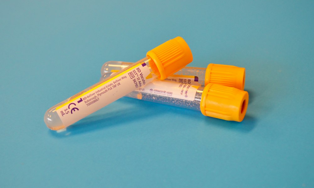 Clomiphene, blood lipids and bone health